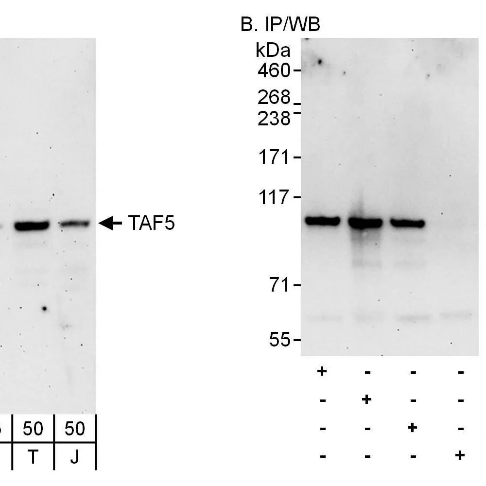 Rabbit anti-TAF5 Antibody, Affinity Purified
