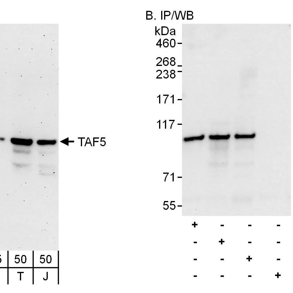 Rabbit anti-TAF5 Antibody, Affinity Purified