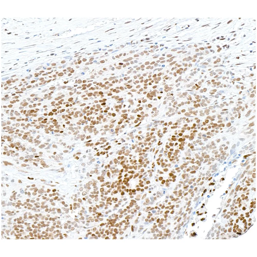 Rabbit anti-SAMHD1 Antibody, Affinity Purified