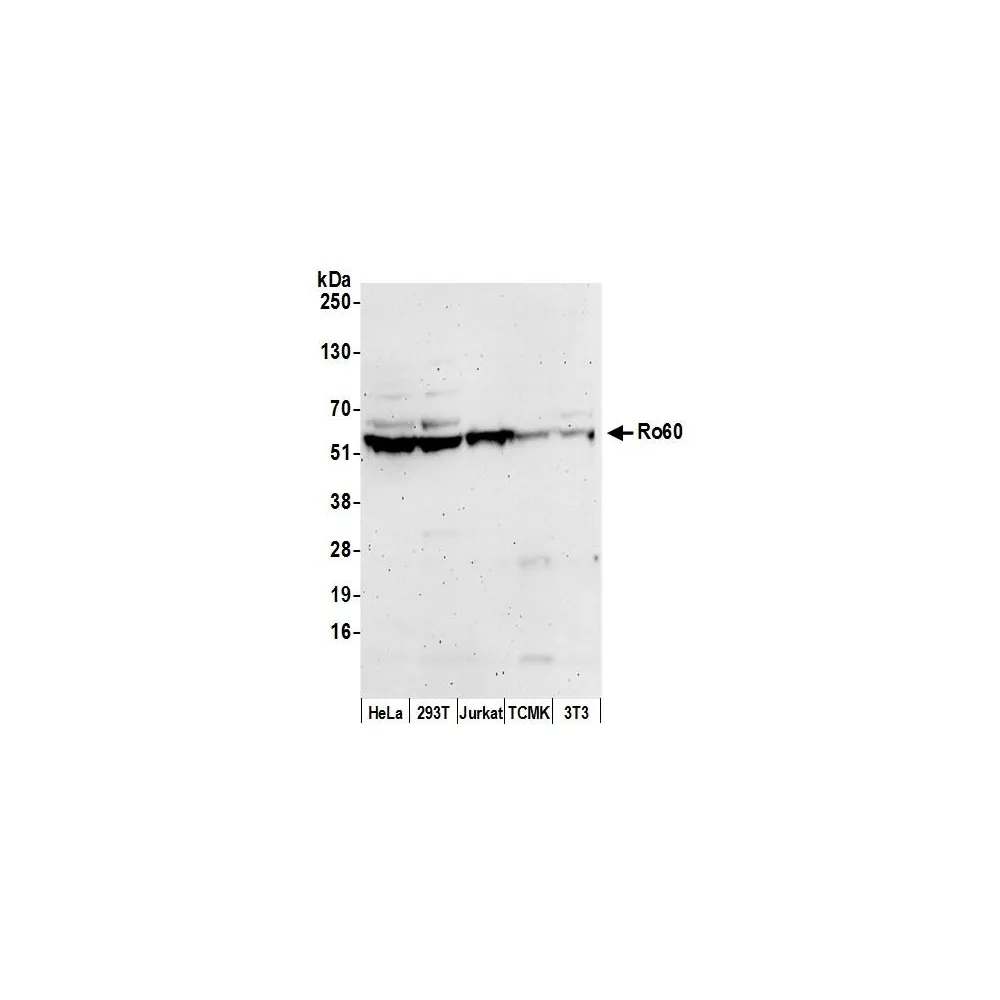 Rabbit anti-Ro60 Antibody, Affinity Purified