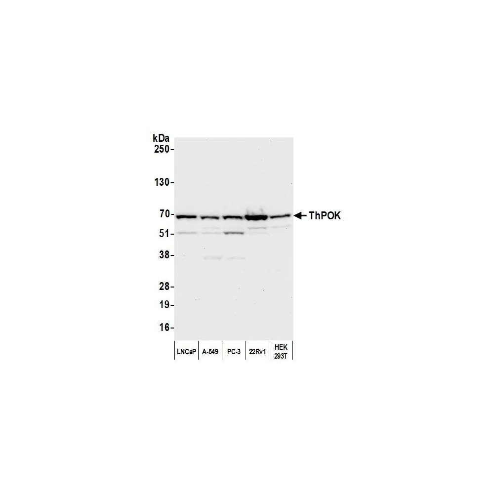 Rabbit anti-ThPOK Antibody, Affinity Purified