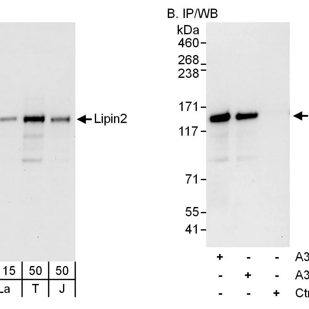 Rabbit anti-Lipin2 Antibody, Affinity Purified