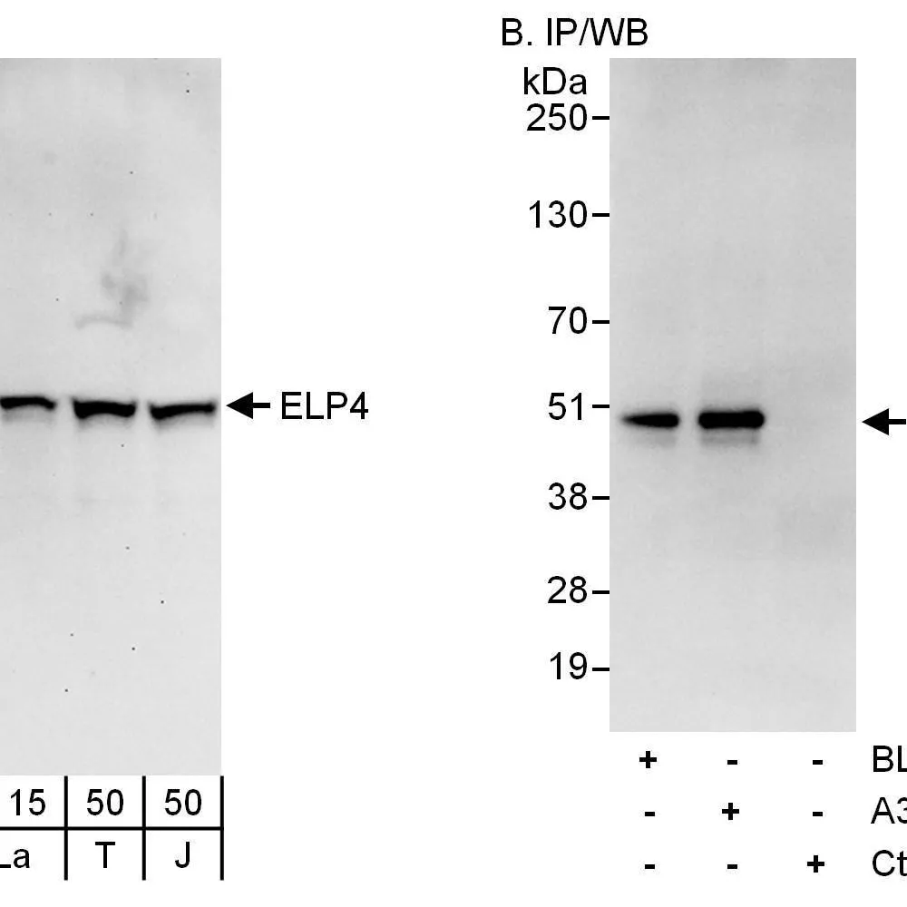 Rabbit anti-ELP4 Antibody, Affinity Purified