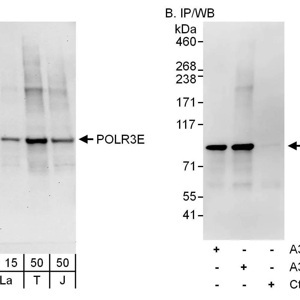 Rabbit anti-POLR3E Antibody, Affinity Purified