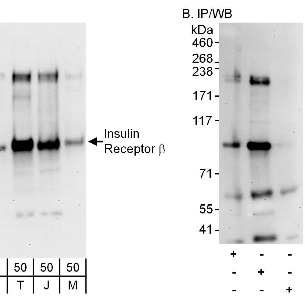 Rabbit anti-Insulin Receptor Beta Antibody, Affinity Purified