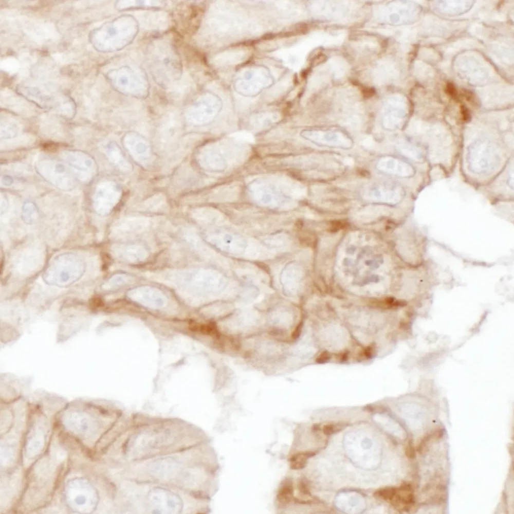 Rabbit anti-Alpha-Adducin Antibody, Affinity Purified
