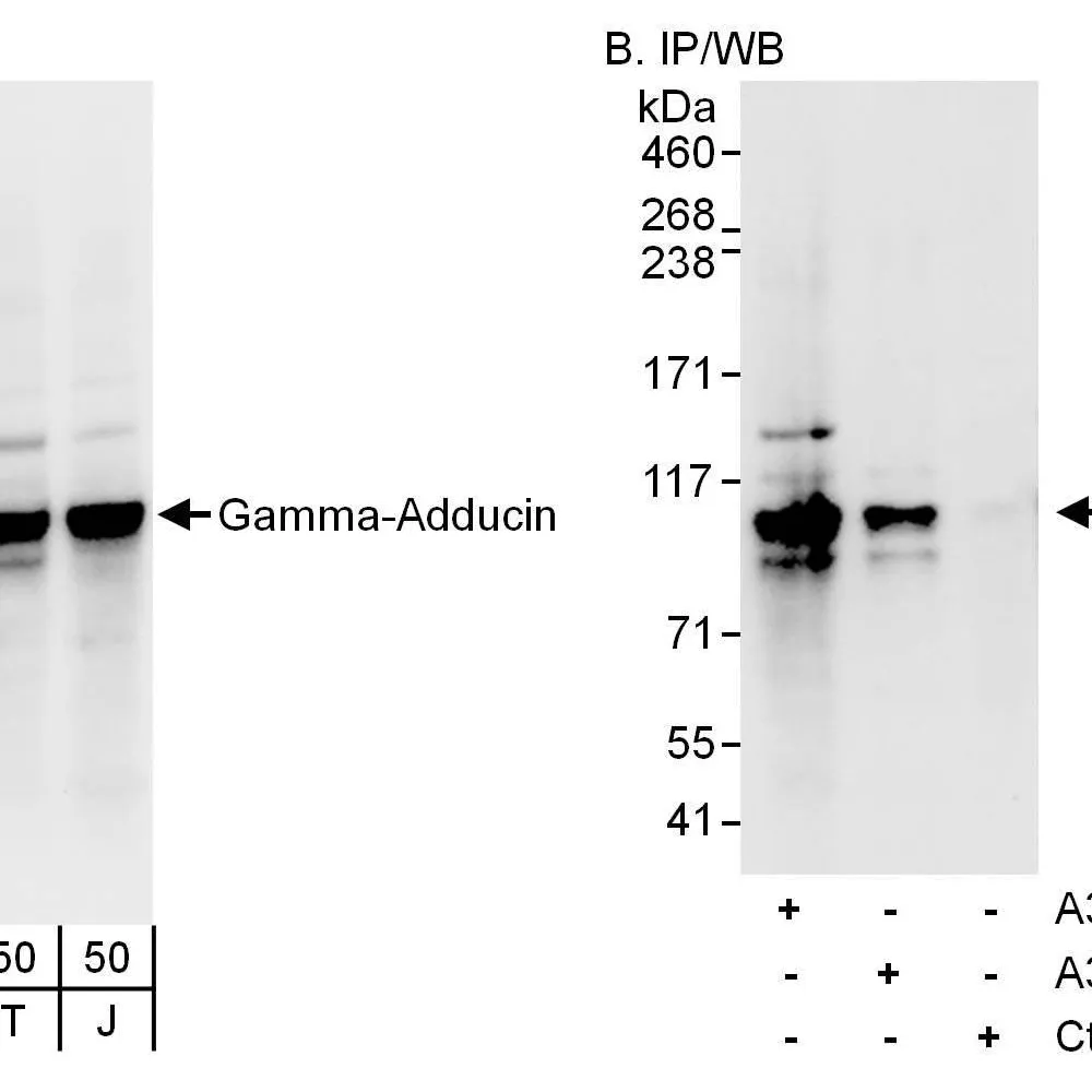 Rabbit anti-Gamma-Adducin Antibody, Affinity Purified