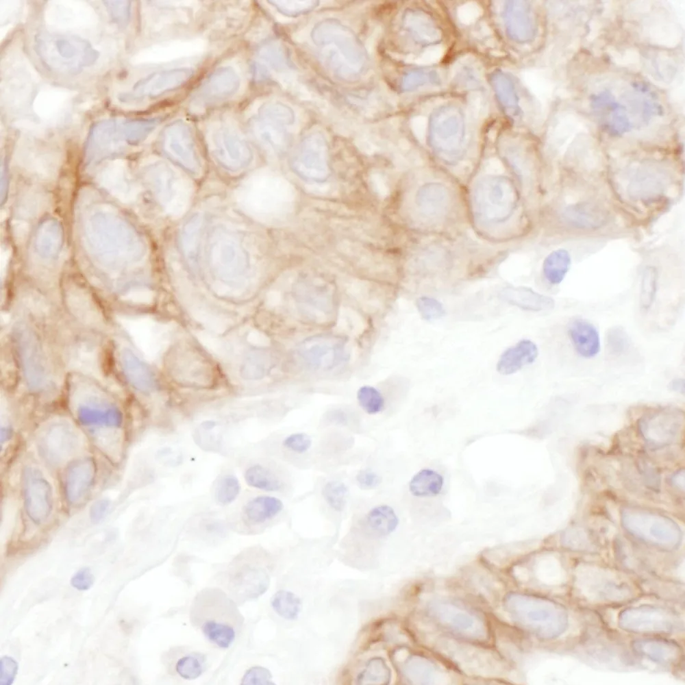 Rabbit anti-Plakoglobin Antibody, Affinity Purified