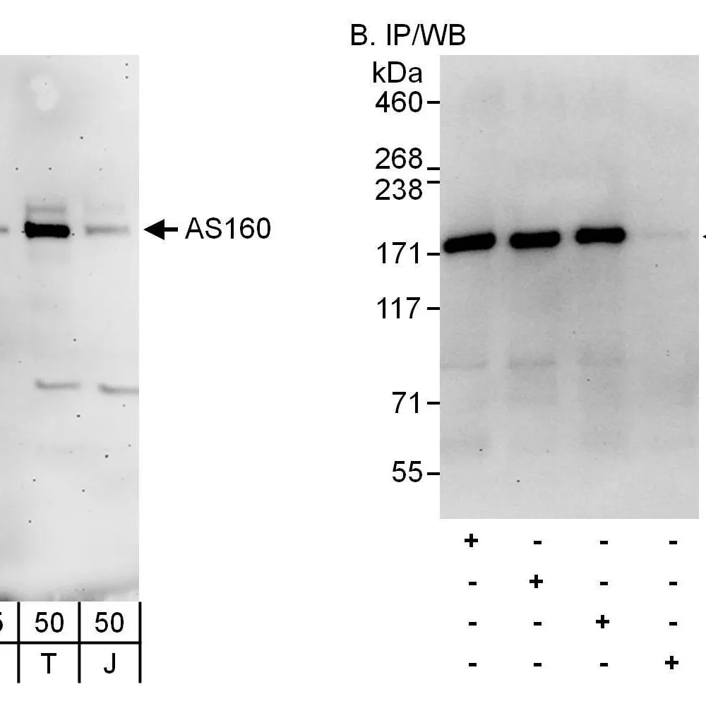 Rabbit anti-AS160 Antibody, Affinity Purified