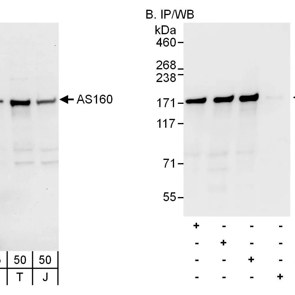Rabbit anti-AS160 Antibody, Affinity Purified