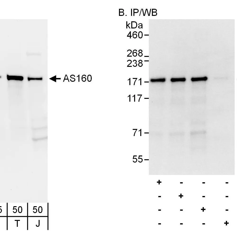 Rabbit anti-AS160 Antibody, Affinity Purified