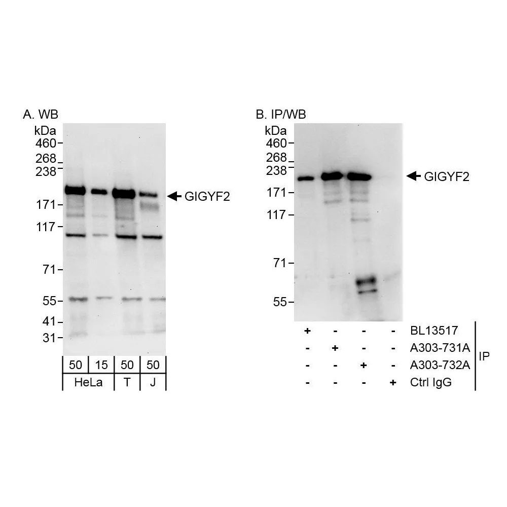 Rabbit anti-GIGYF2 Antibody, Affinity Purified