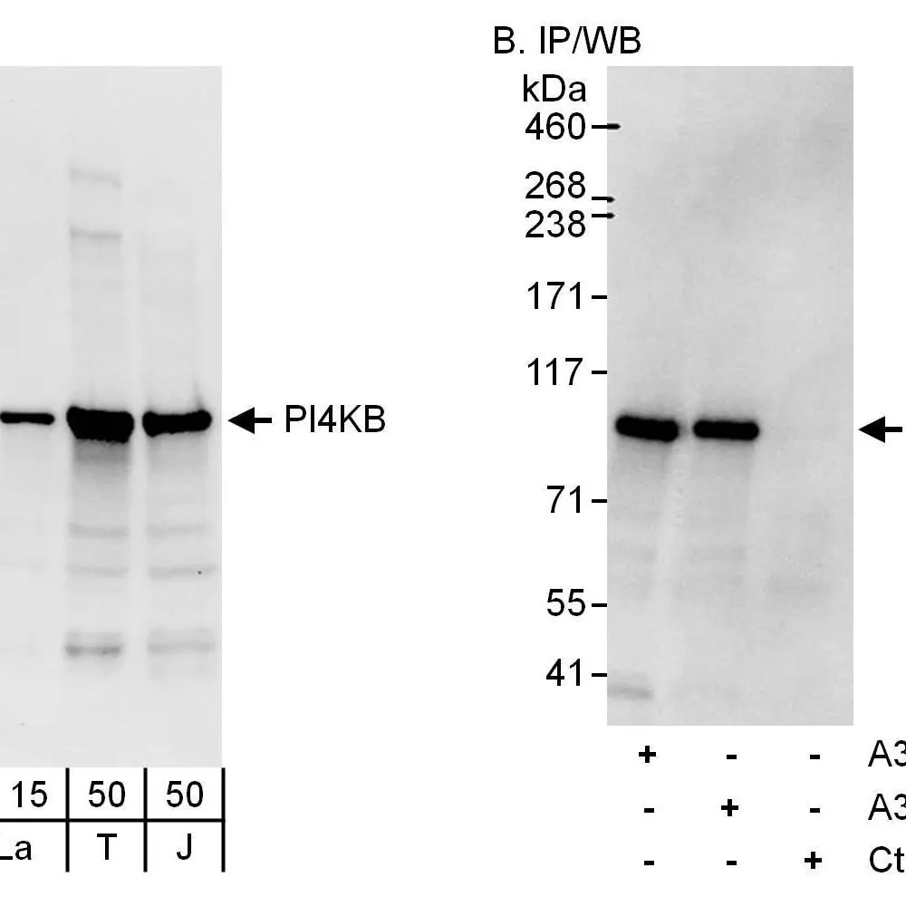 Rabbit anti-PI4KB Antibody, Affinity Purified