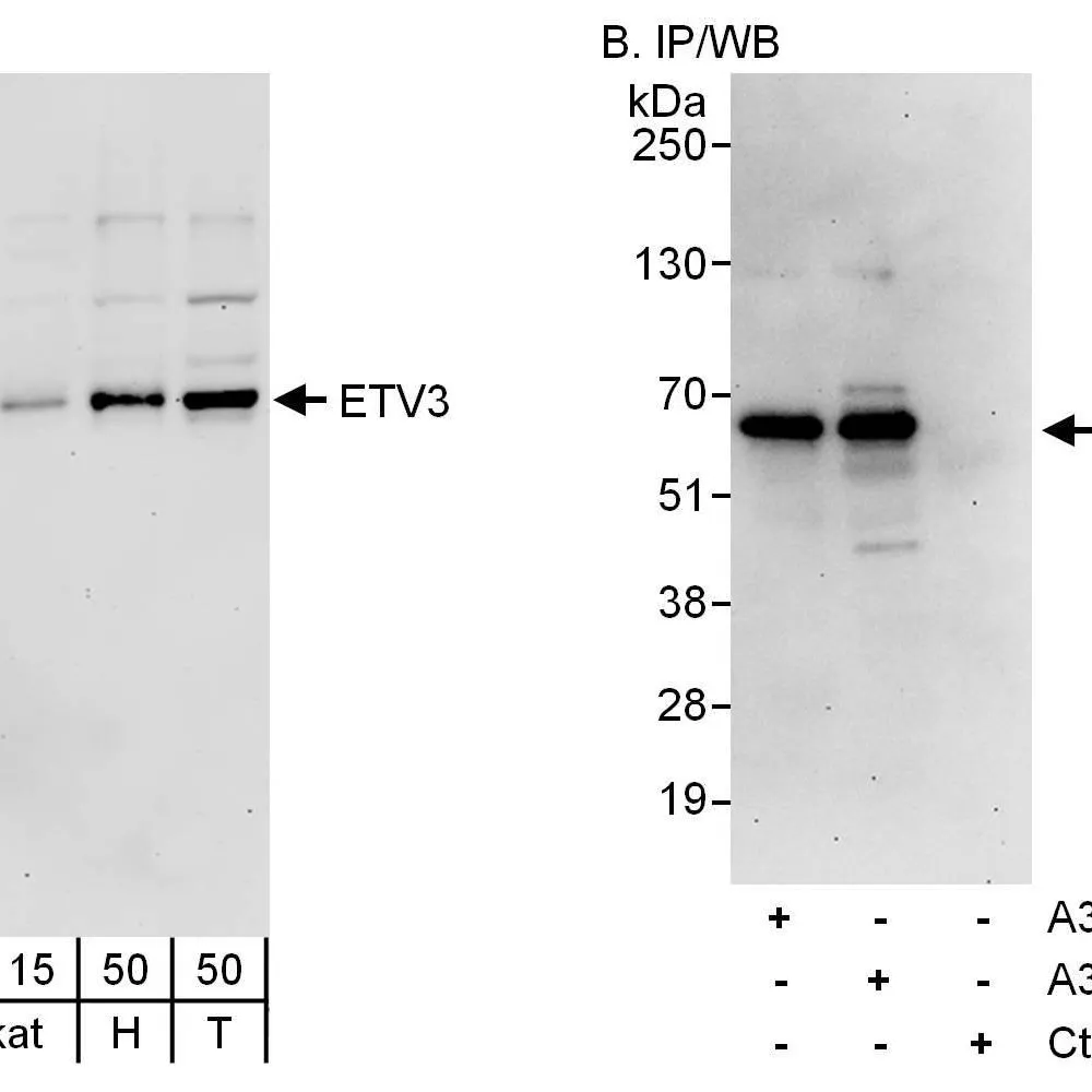 Rabbit anti-ETV3 Antibody, Affinity Purified