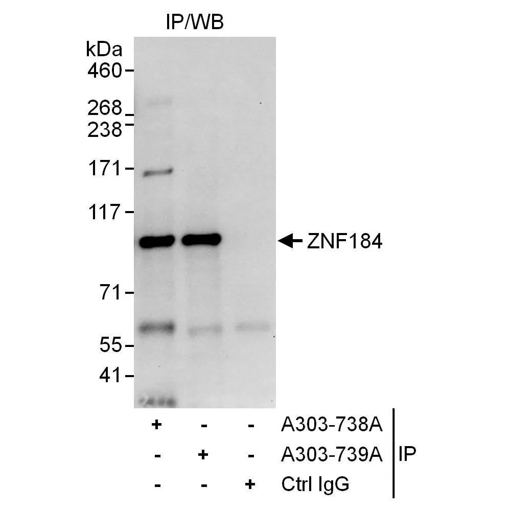 Rabbit anti-ZNF184 Antibody, Affinity Purified