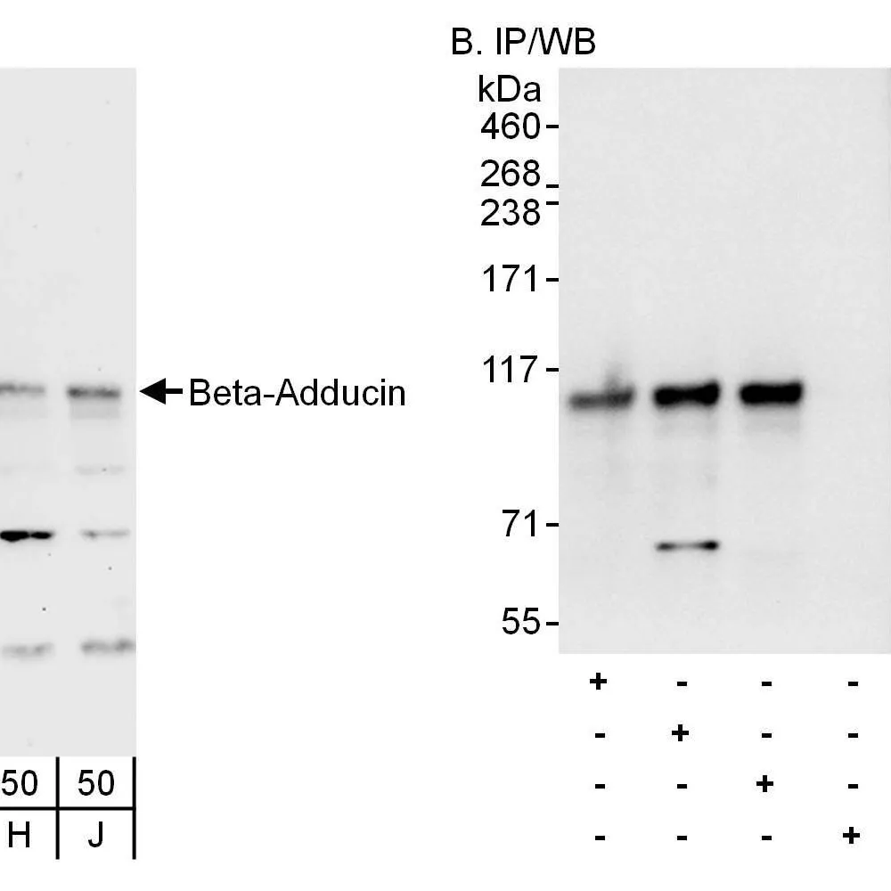 Rabbit anti-Beta-Adducin Antibody, Affinity Purified