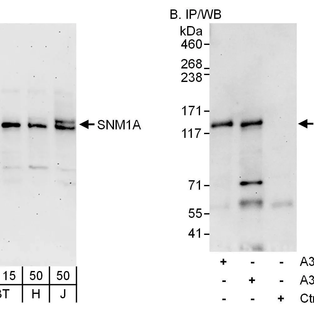 Rabbit anti-SNM1A Antibody, Affinity Purified