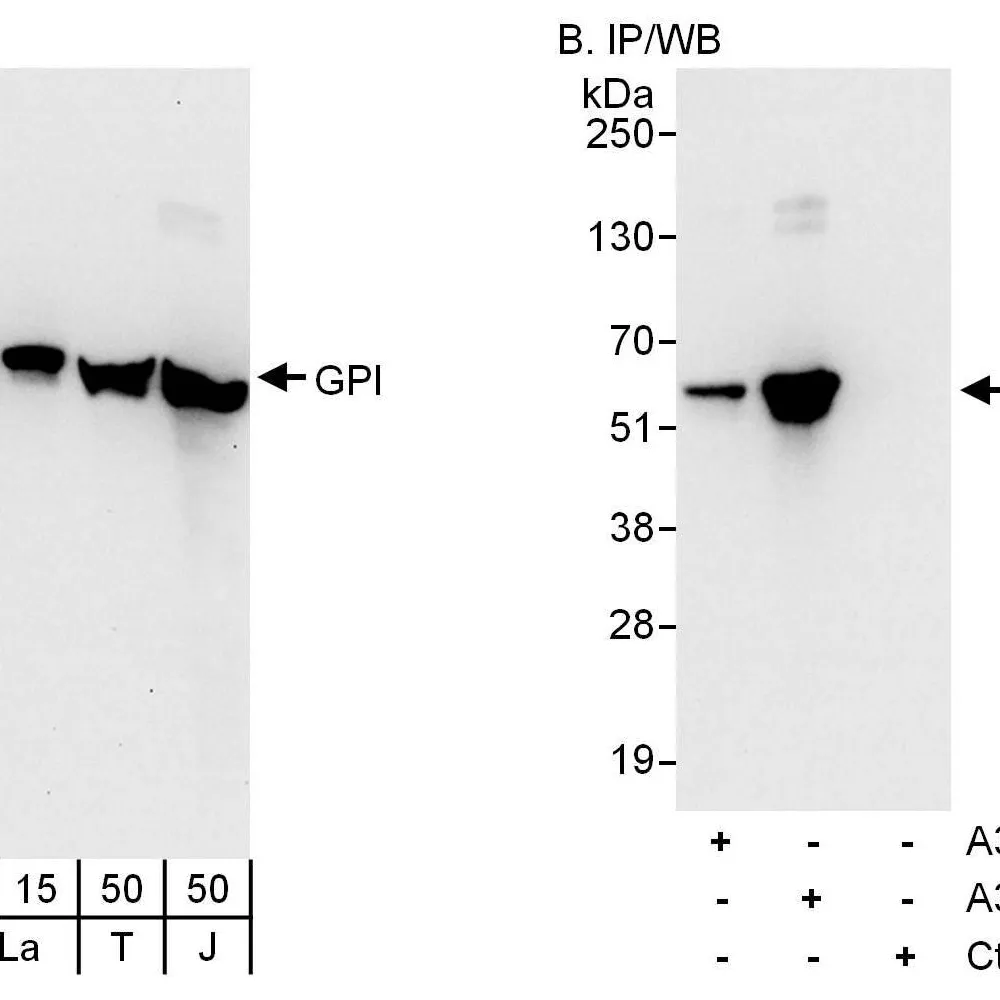 Rabbit anti-GPI Antibody, Affinity Purified