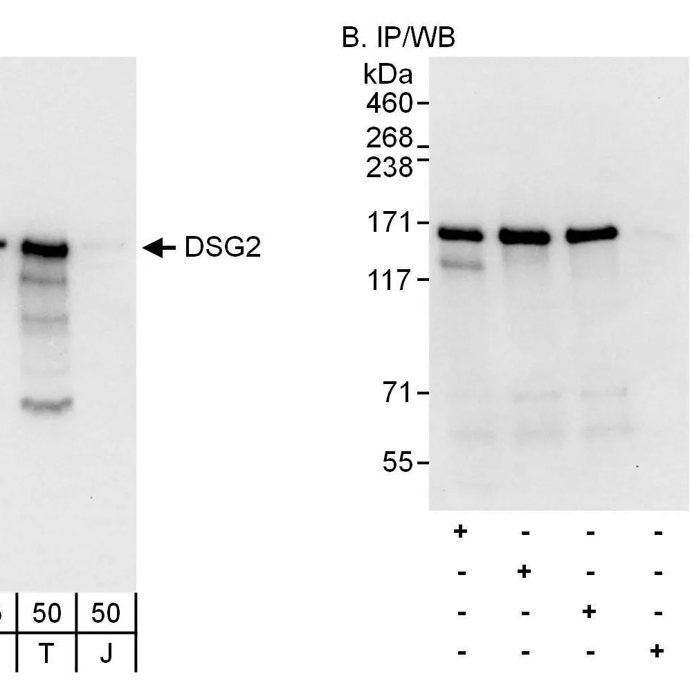 Rabbit anti-DSG2 Antibody, Affinity Purified