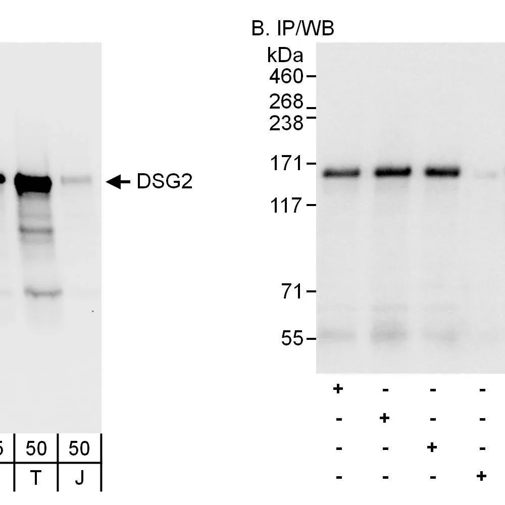 Rabbit anti-DSG2 Antibody, Affinity Purified