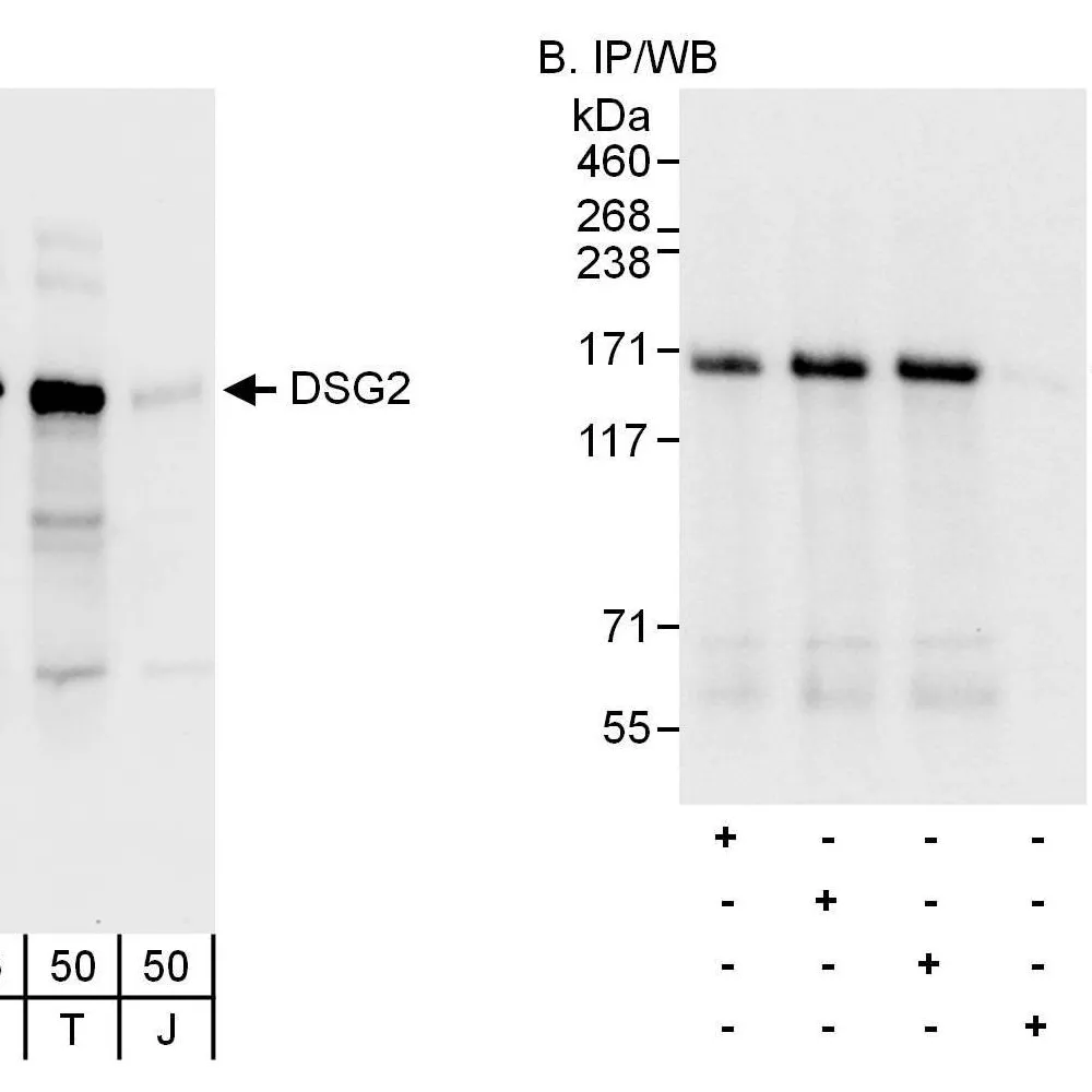 Rabbit anti-DSG2 Antibody, Affinity Purified