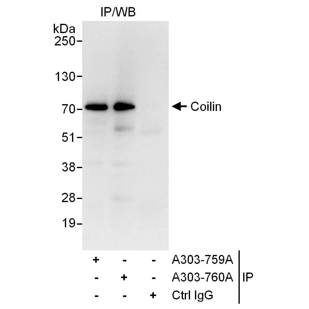 Rabbit anti-Coilin Antibody, Affinity Purified