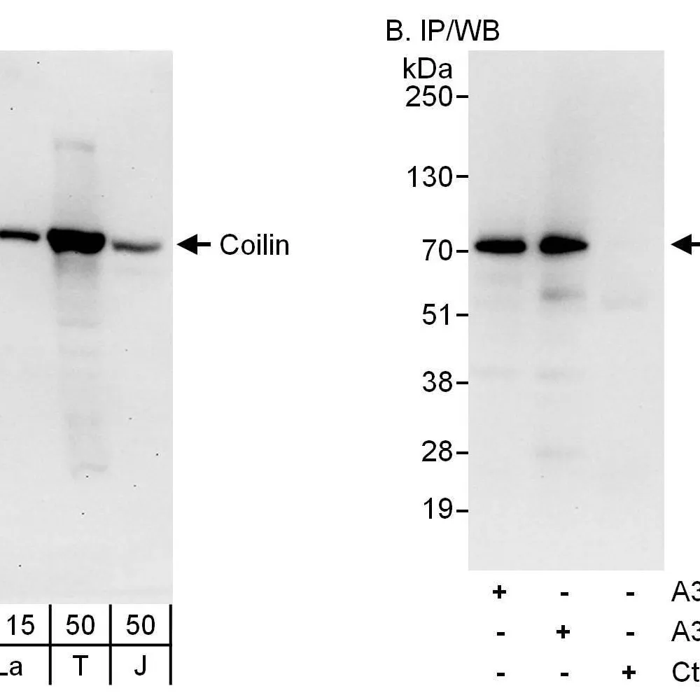 Rabbit anti-Coilin Antibody, Affinity Purified