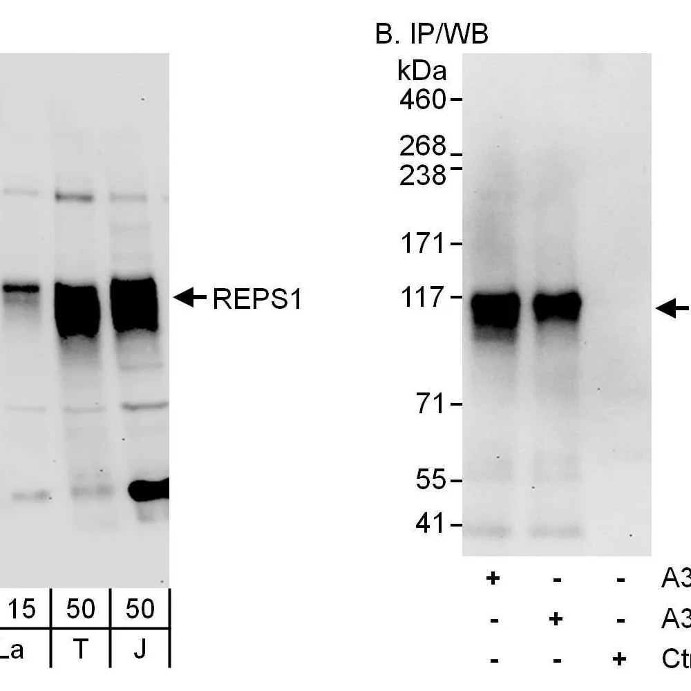 Rabbit anti-REPS1 Antibody, Affinity Purified