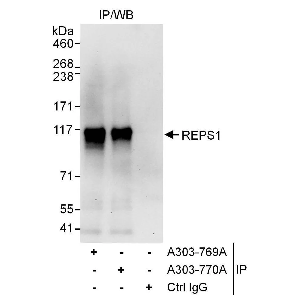Rabbit anti-REPS1 Antibody, Affinity Purified