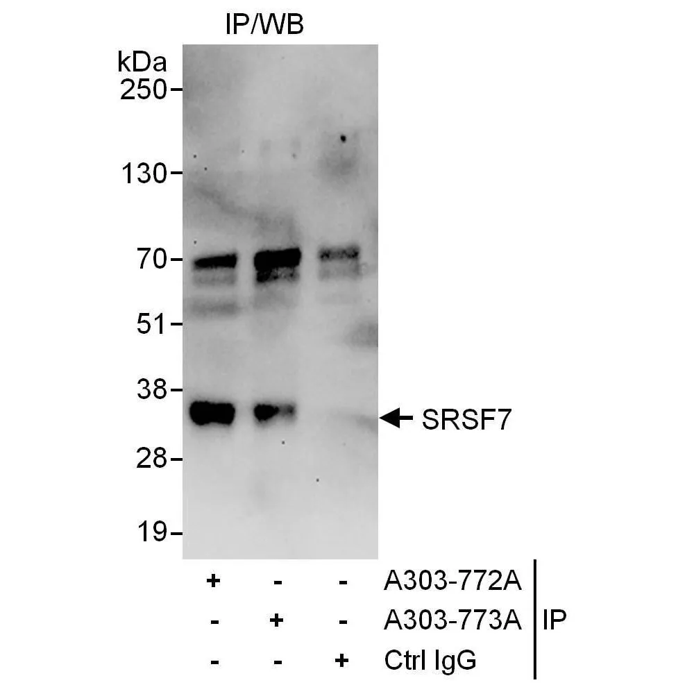 Rabbit anti-SRSF7 Antibody, Affinity Purified