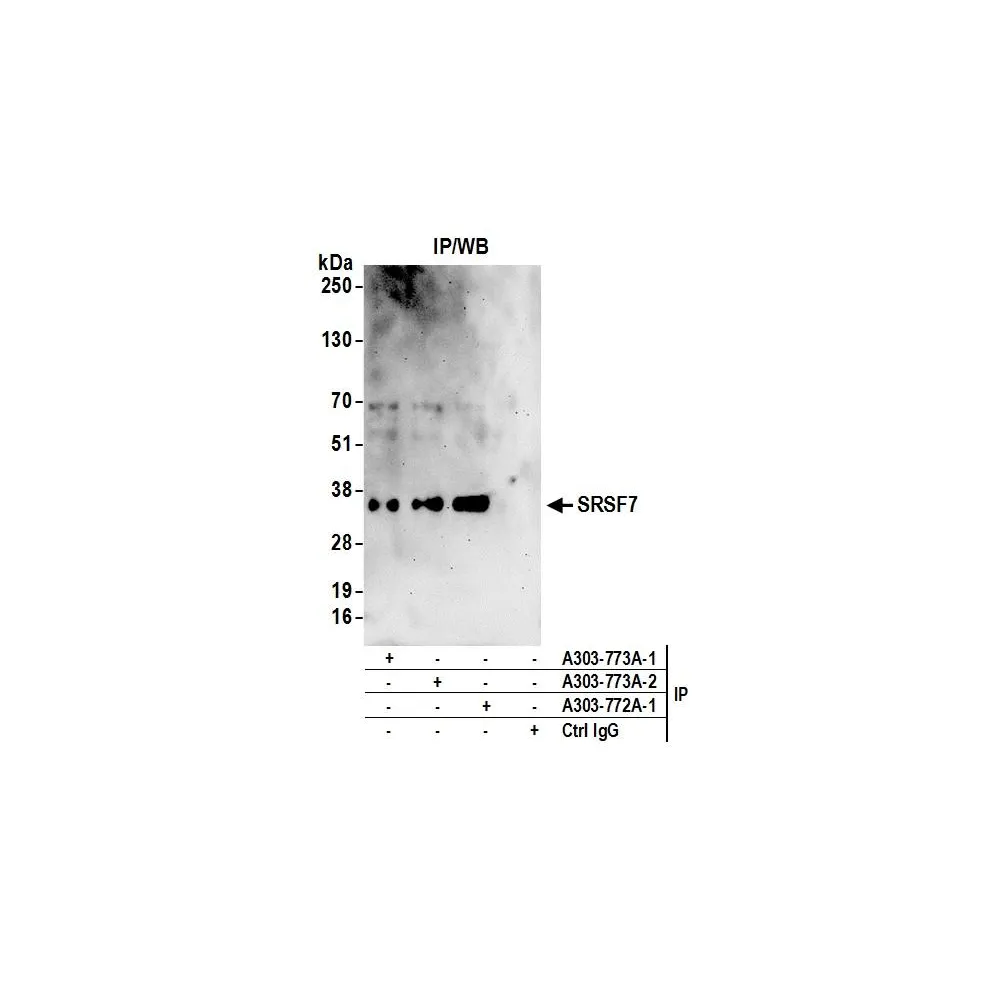 Rabbit anti-SRSF7 Antibody, Affinity Purified