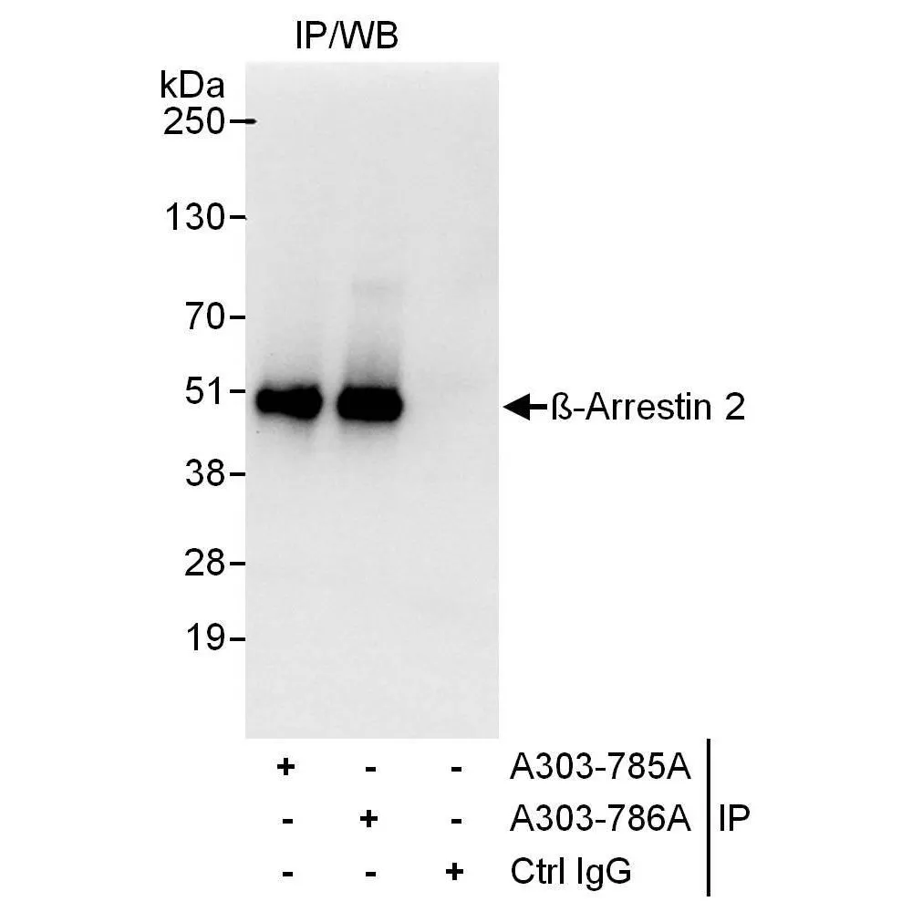 Rabbit anti-Beta-Arrestin 2 Antibody, Affinity Purified