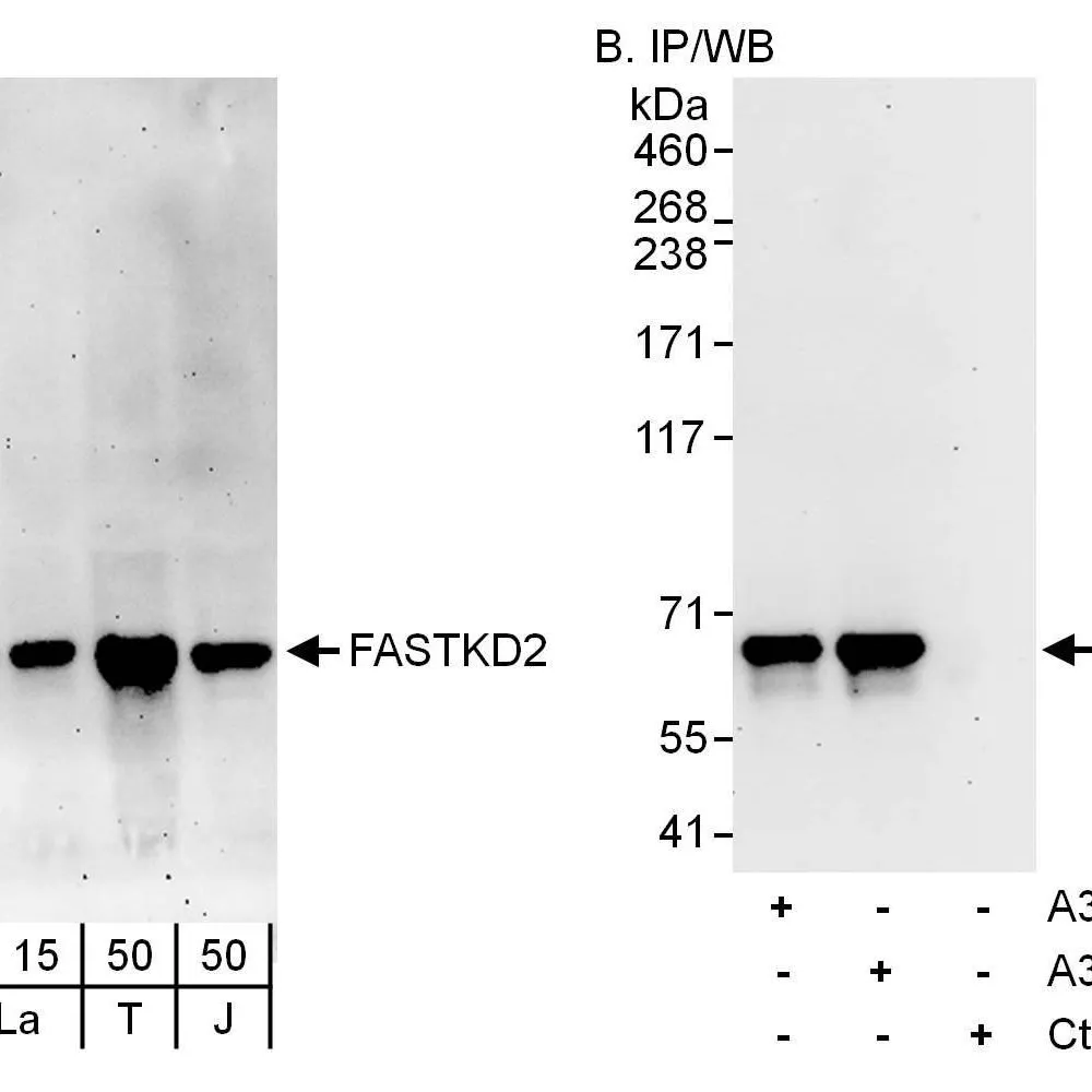 Rabbit anti-FASTKD2 Antibody, Affinity Purified