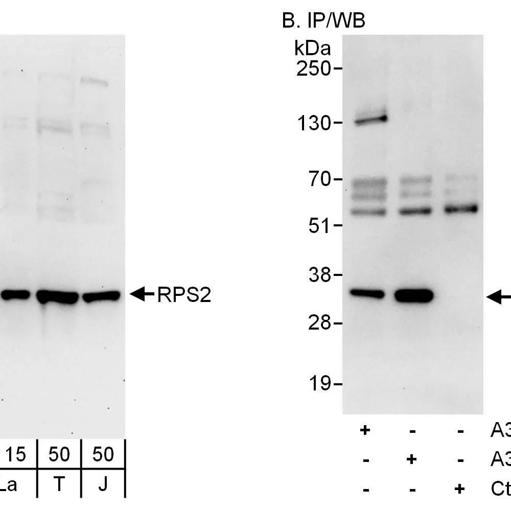 Rabbit anti-RPS2 Antibody, Affinity Purified