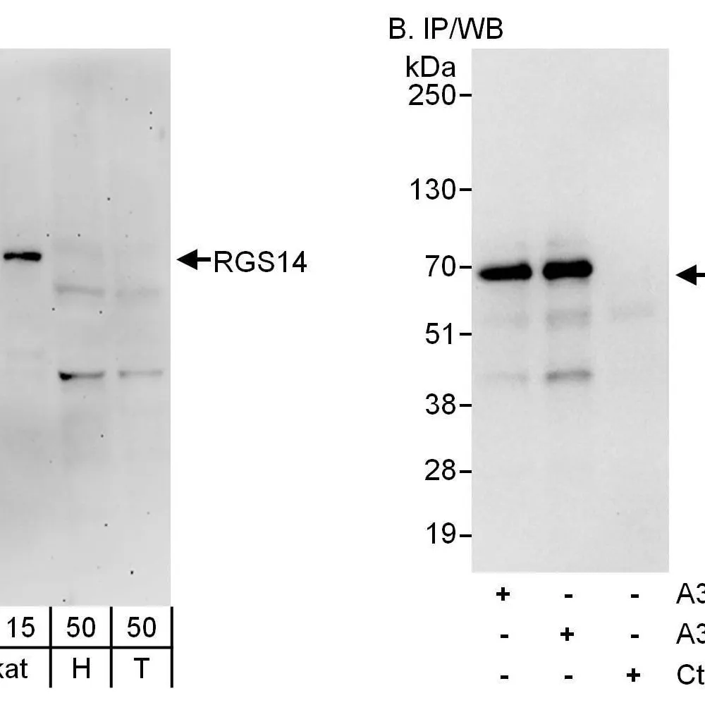 Rabbit anti-RGS14 Antibody, Affinity Purified