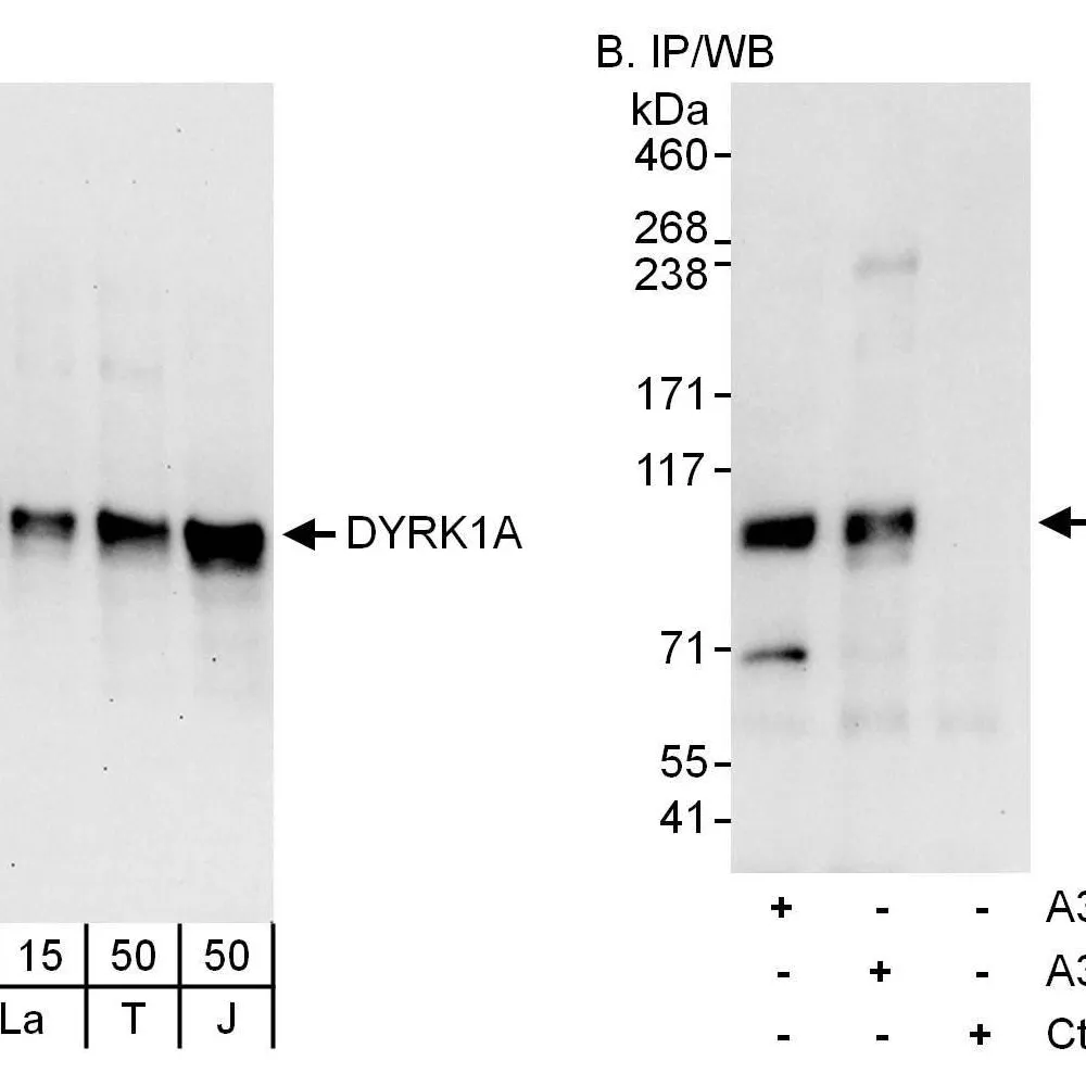 Rabbit anti-DYRK1A Antibody, Affinity Purified
