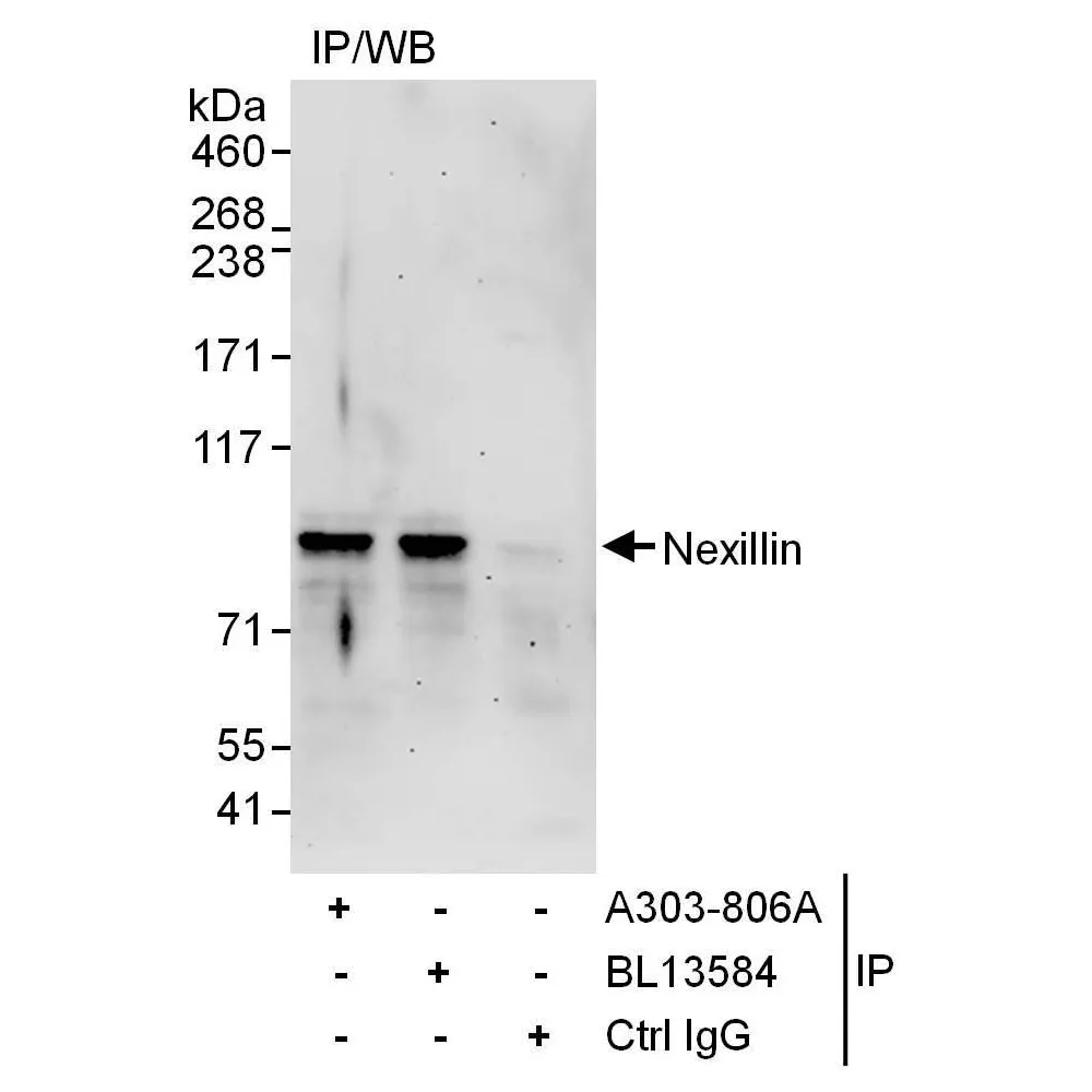 Rabbit anti-Nexilin Antibody, Affinity Purified