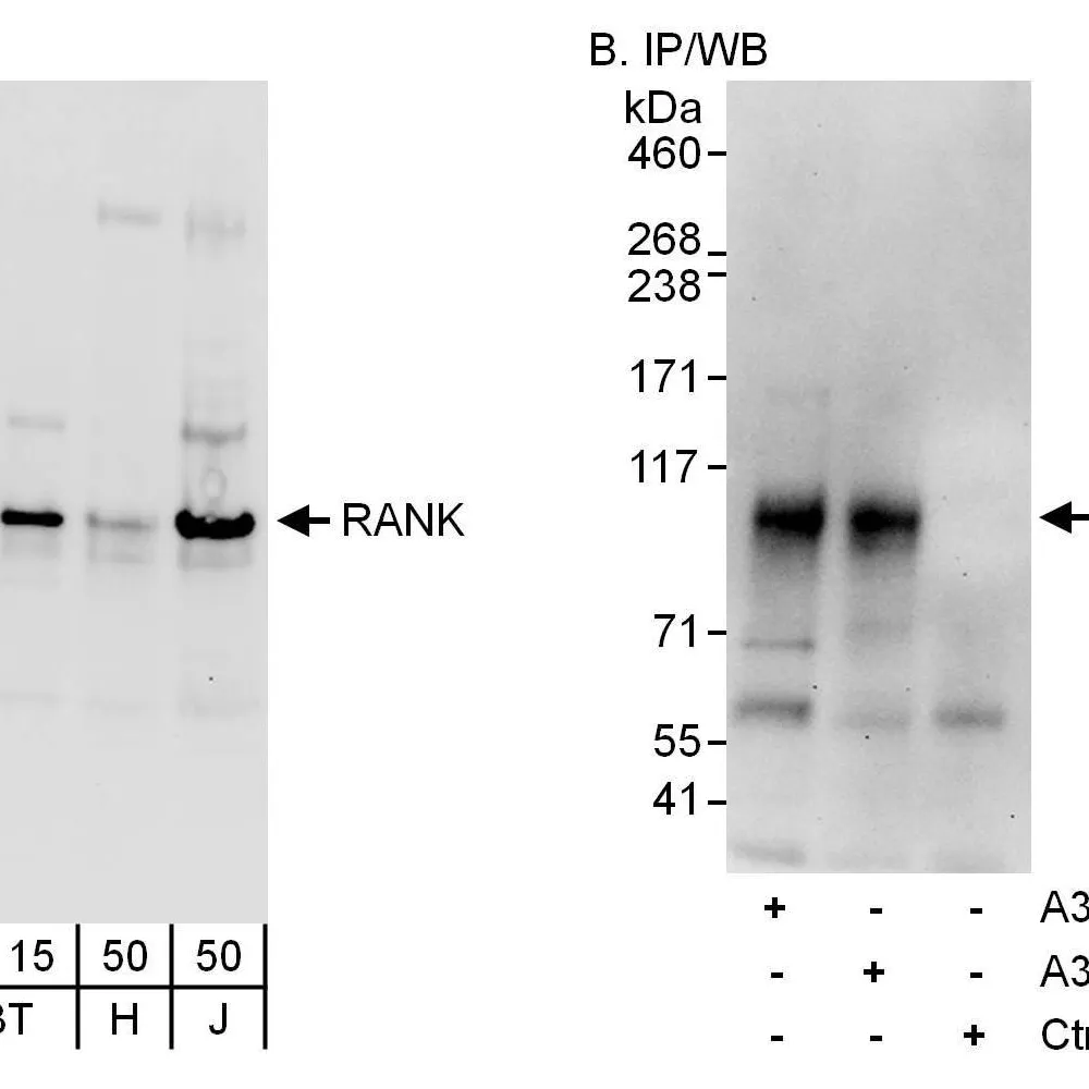 Rabbit anti-RANK Antibody, Affinity Purified