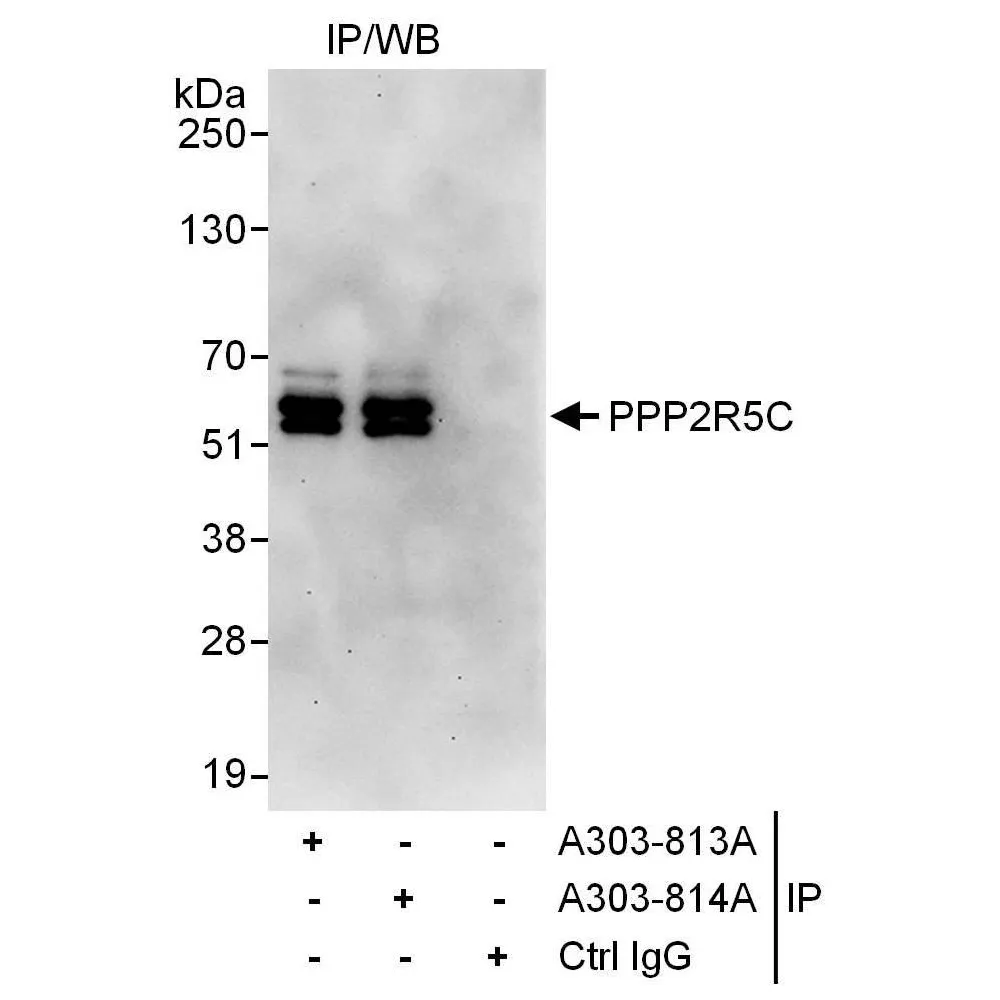 Rabbit anti-PPP2R5C Antibody, Affinity Purified