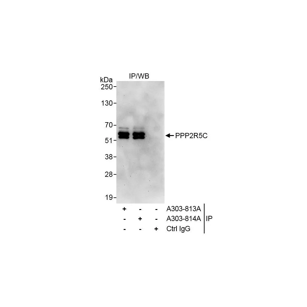 Rabbit anti-PPP2R5C Antibody, Affinity Purified