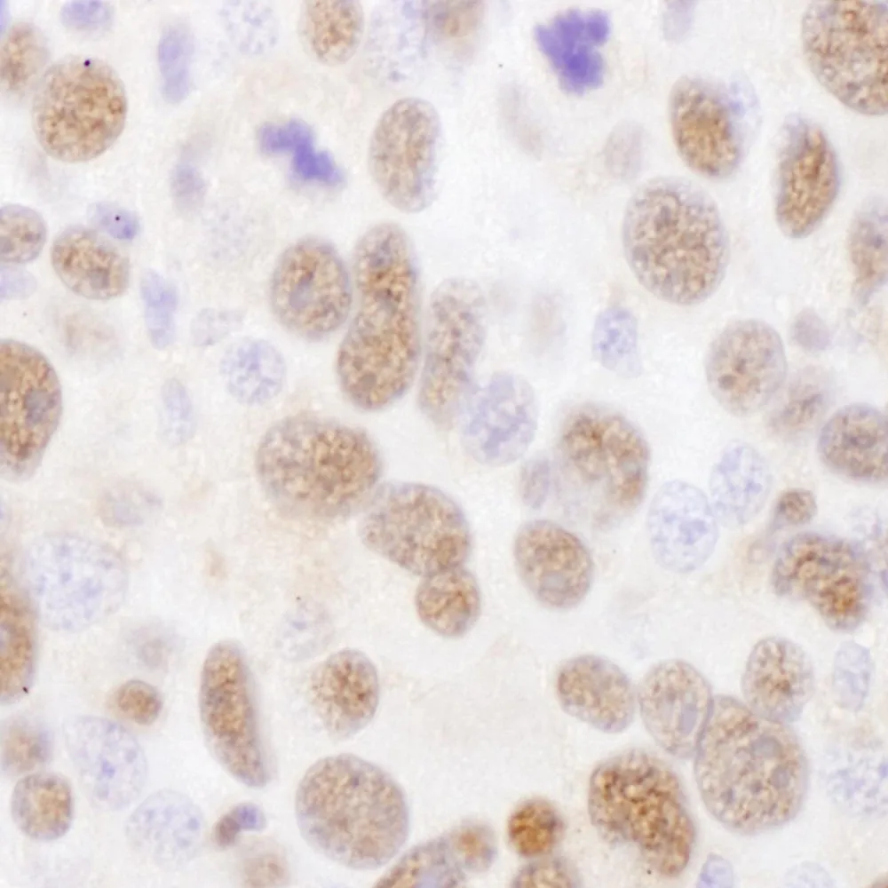 Rabbit anti-PSMA2 Antibody, Affinity Purified