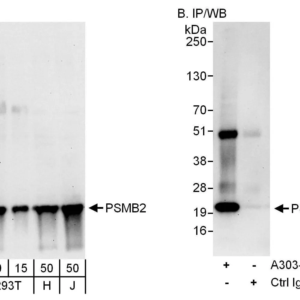 Rabbit anti-PSMB2 Antibody, Affinity Purified