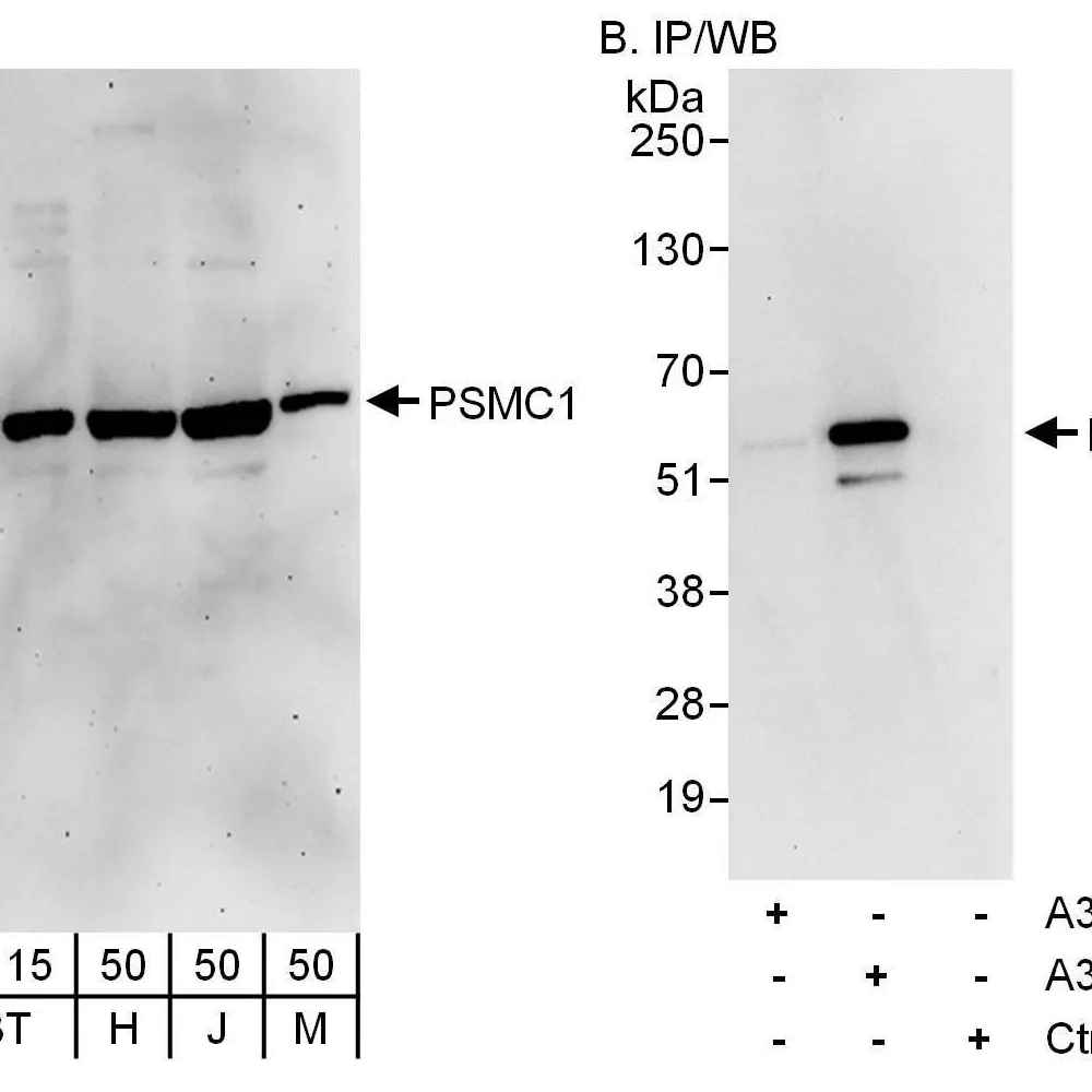 Rabbit anti-PSMC1 Antibody, Affinity Purified