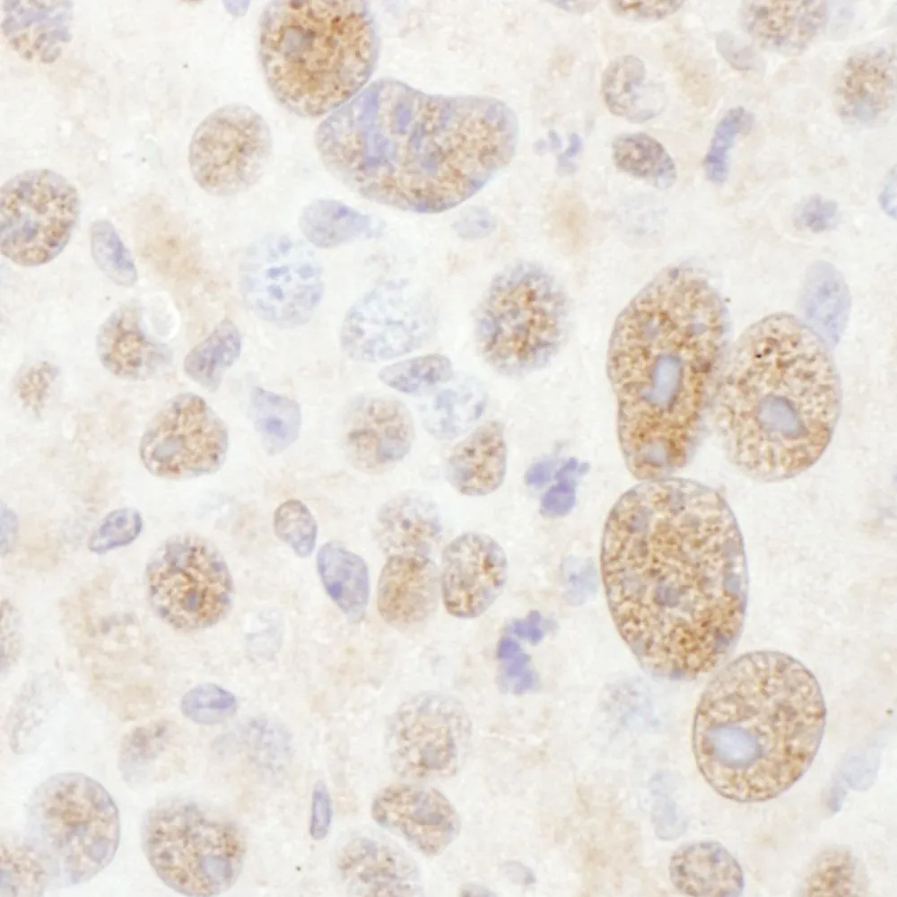 Rabbit anti-PSMC2 Antibody, Affinity Purified