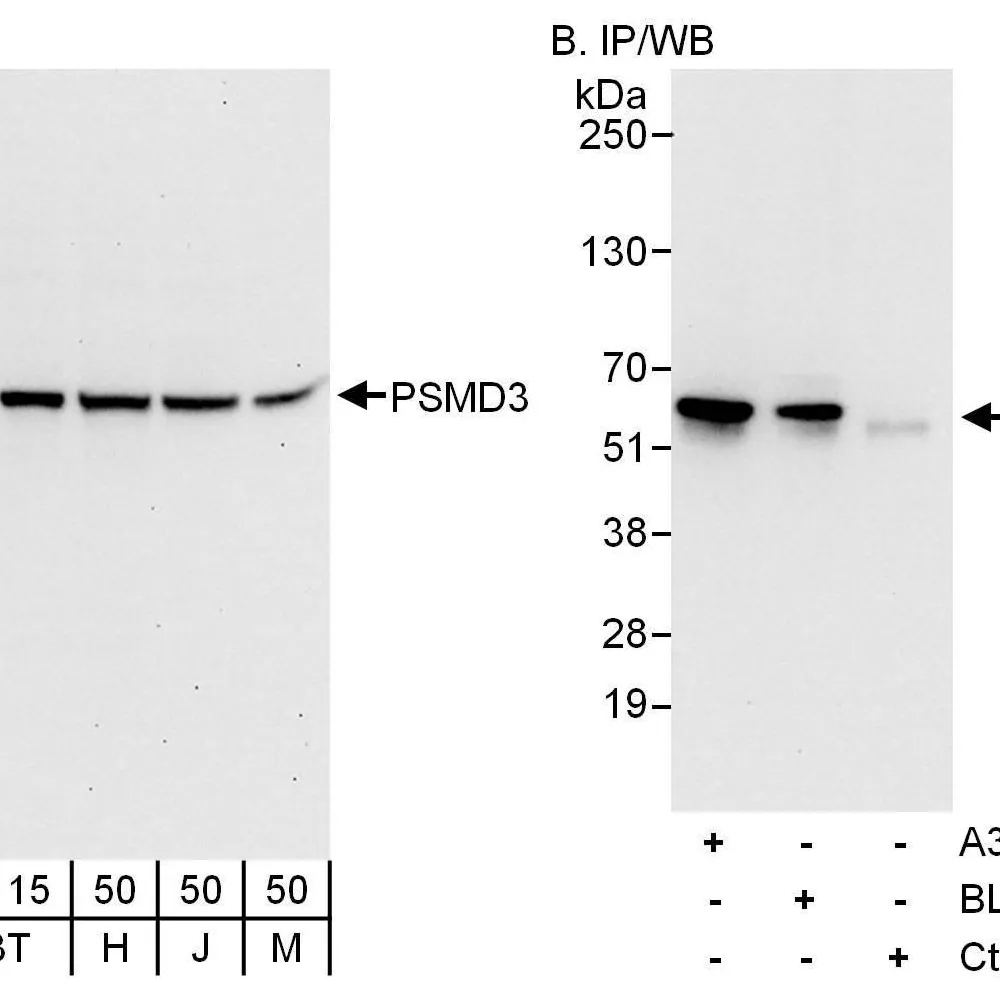 Rabbit anti-PSMD3 Antibody, Affinity Purified