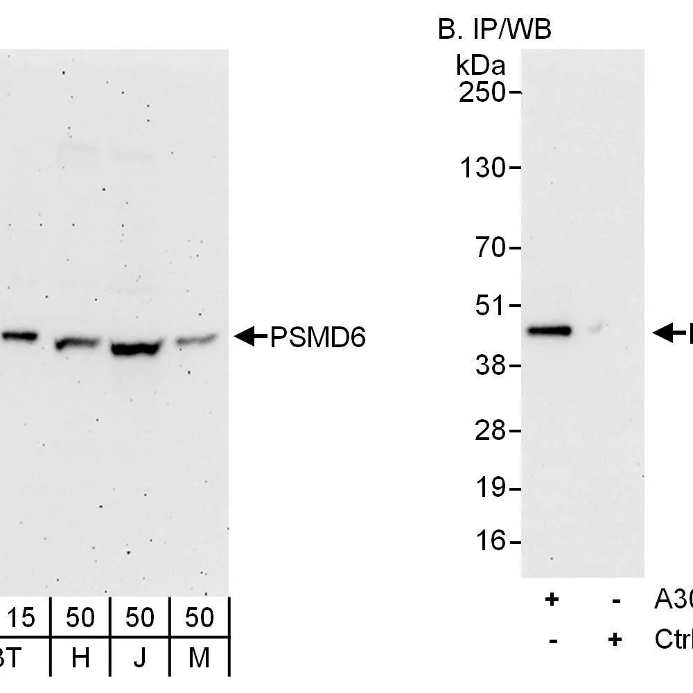 Rabbit anti-PSMD6 Antibody, Affinity Purified