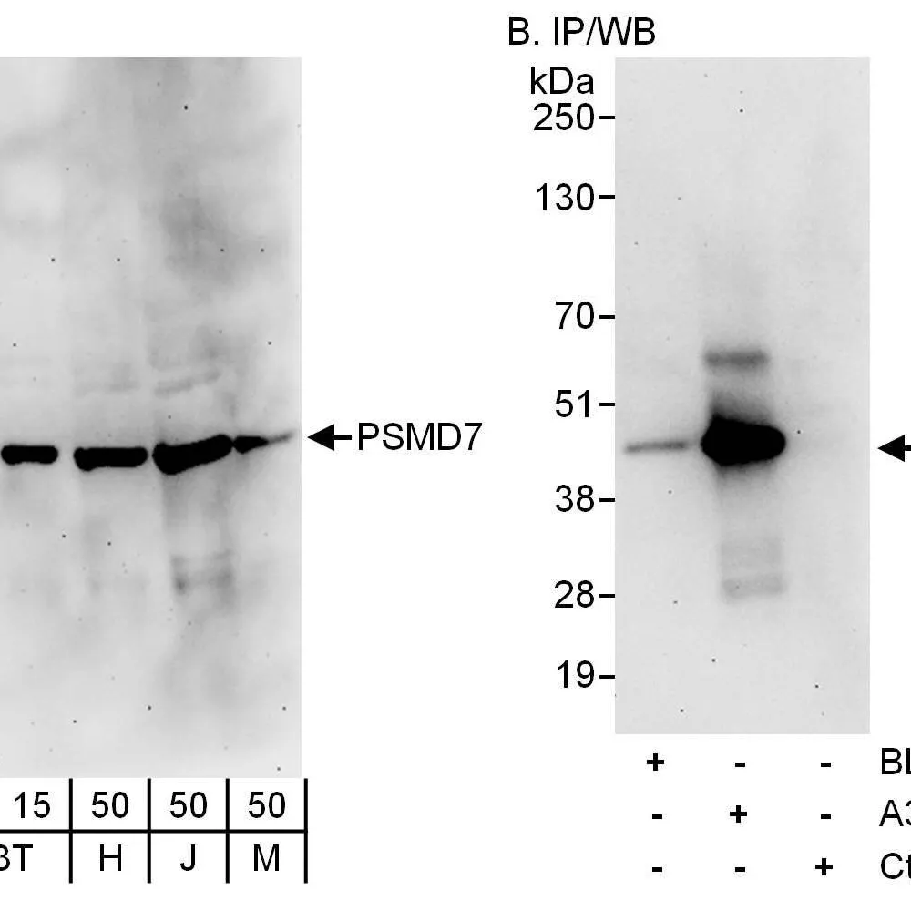 Rabbit anti-PSMD7 Antibody, Affinity Purified