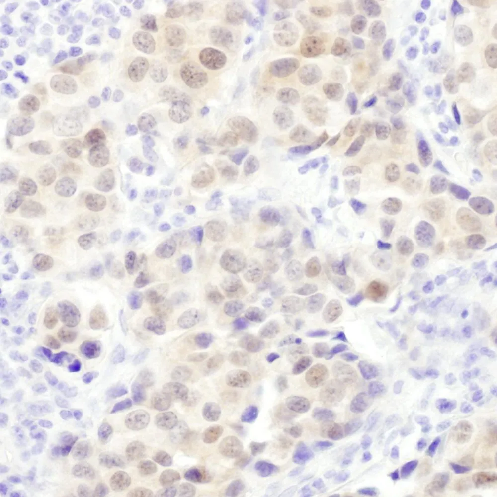 Rabbit anti-PSMB5 Antibody, Affinity Purified