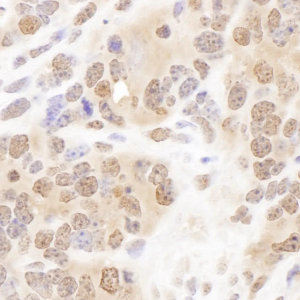 Rabbit anti-PSMB7 Antibody, Affinity Purified