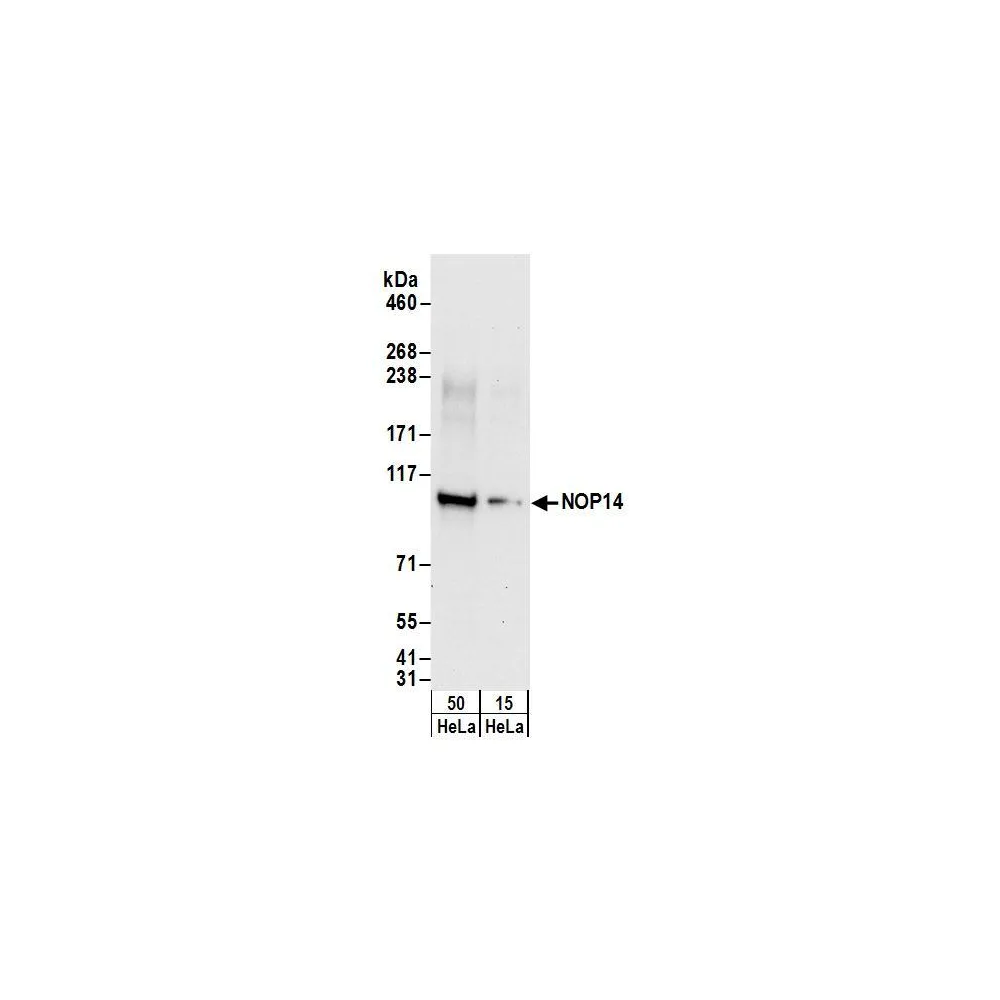 Rabbit anti-NOP14 Antibody, Affinity Purified